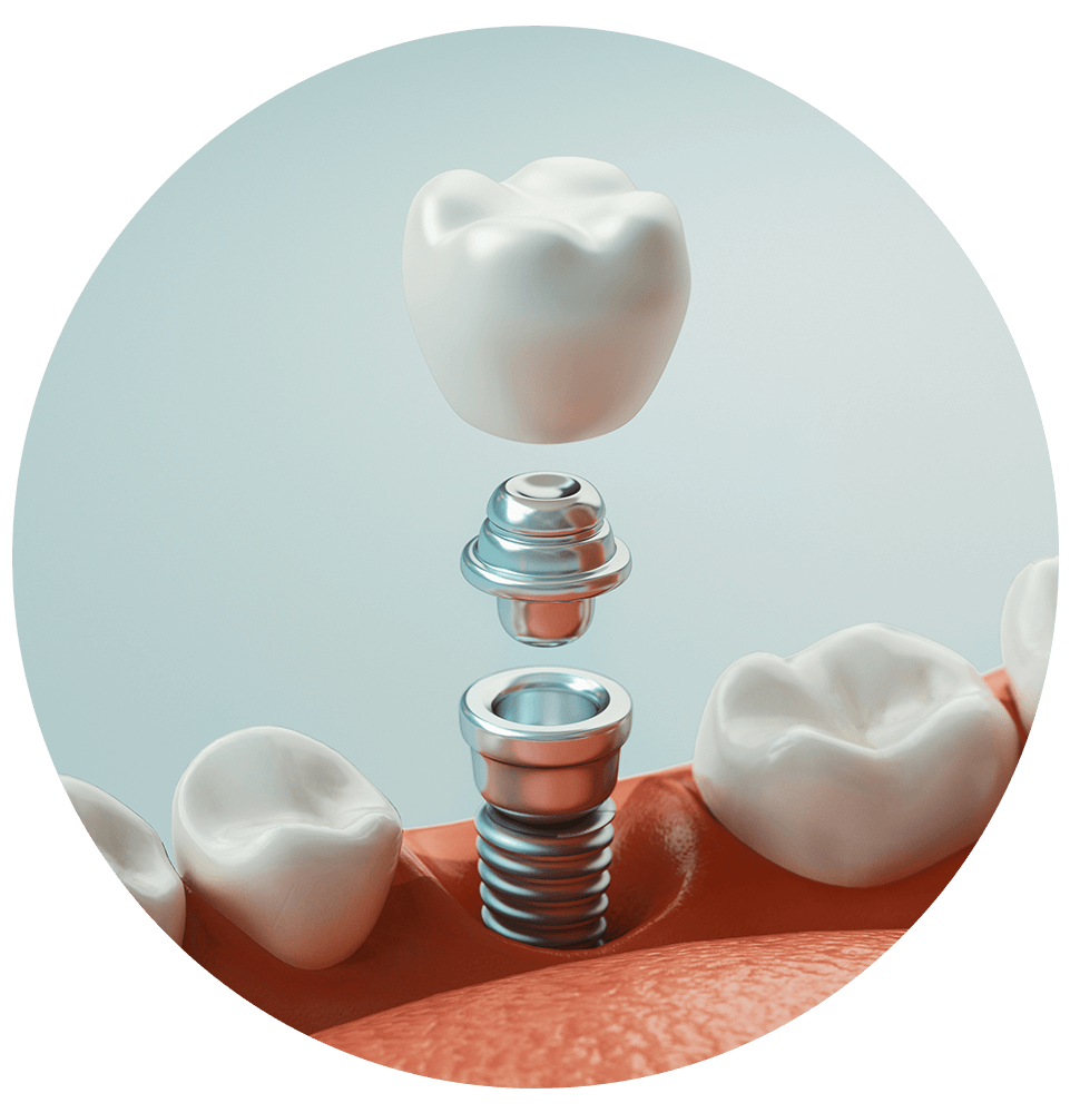 Dental Implants icon