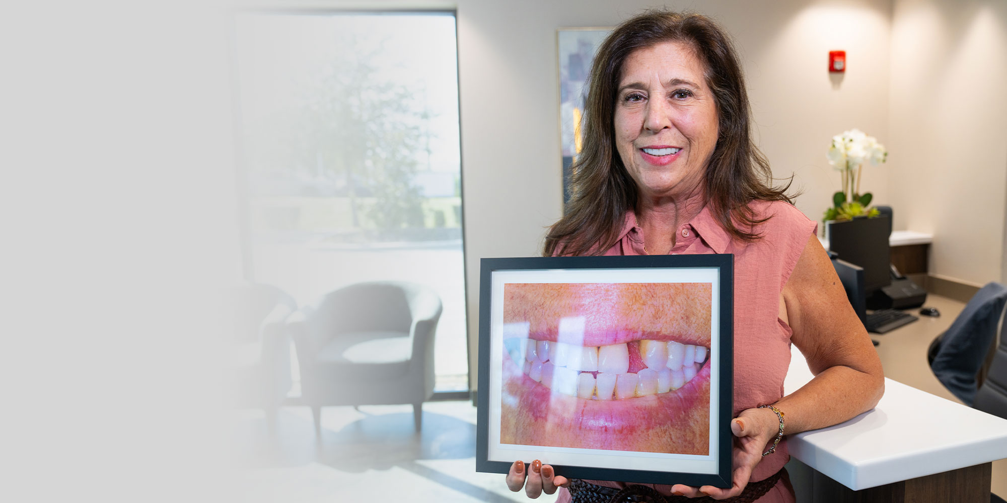 patient holding before image of mouth before dental treatment