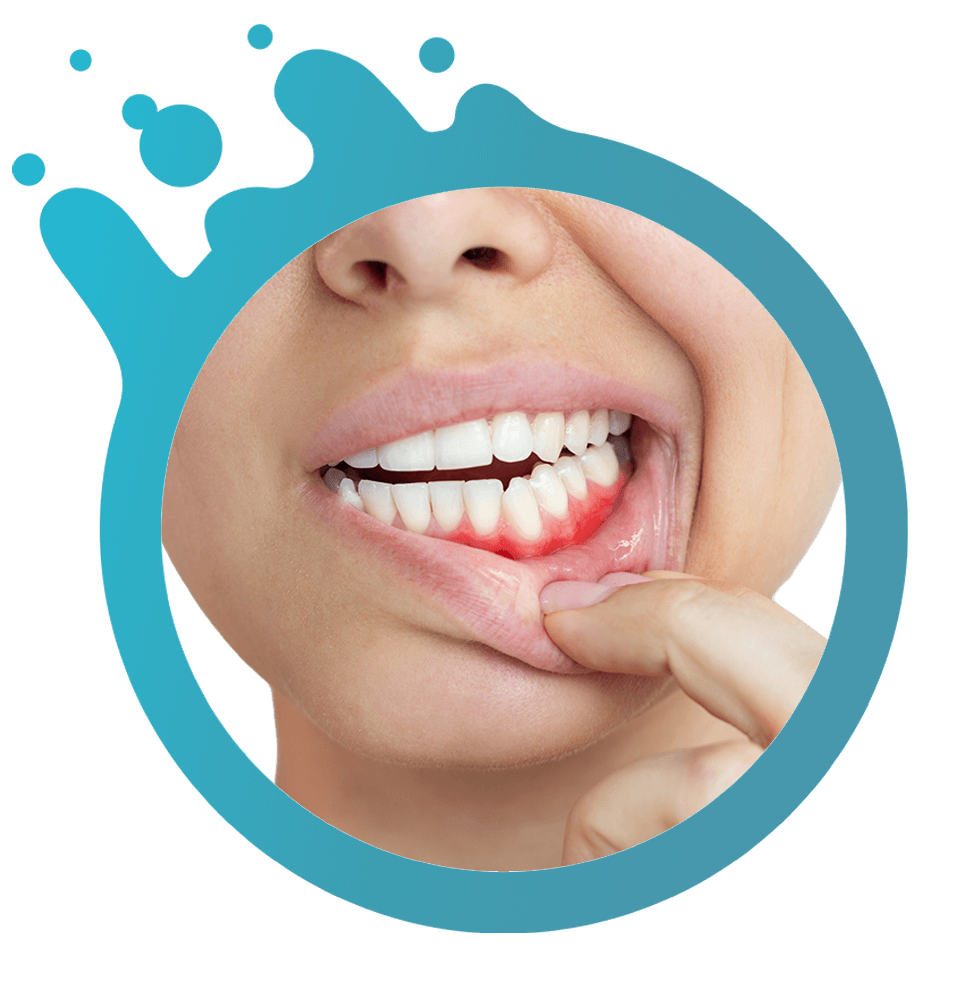 close up of person experience gum inflammation