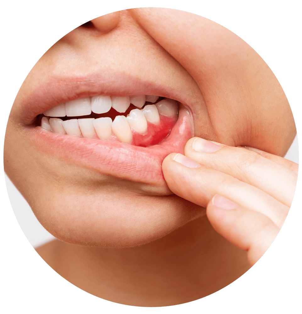 Periodontal Treatment icon